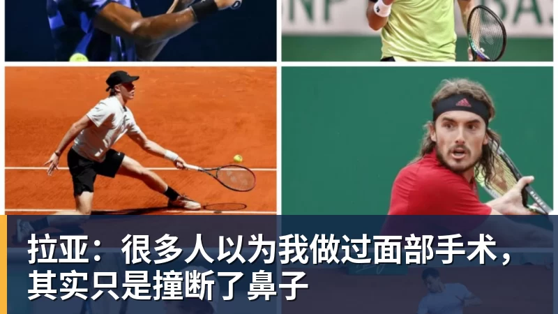 好博体育拉亚：很多人以为我做过面部手术，其实只是撞断了鼻子